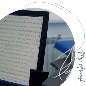 مراحل بعد از qEEG در افسردگی مراحل بعد از qEEG در افسردگی