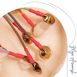 نقش qEEG در پایش پیشرفت بیماری و اثربخشی درمان نقش qEEG در پایش پیشرفت بیماری و اثربخشی درمان